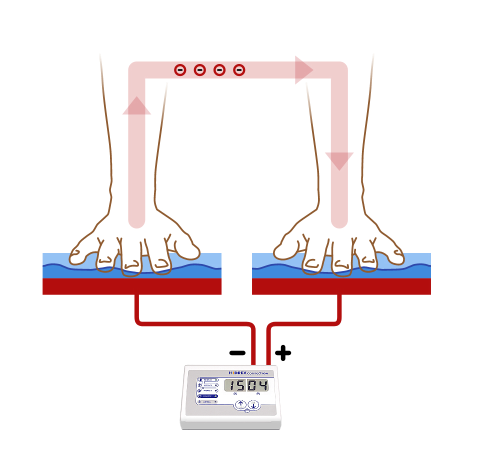 Schwitzende Hände - Behandlung mit der Iontophorese - schematische Darstellung