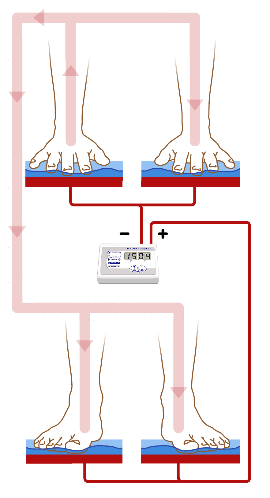 Schema der Iontophorese Behandlung bei Händen und Füßen zusammen - gemeinsam
